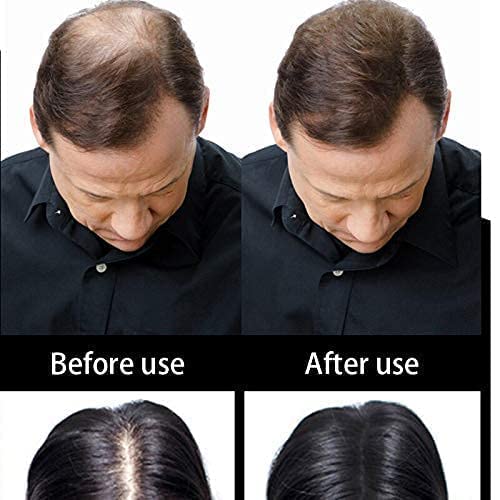 Osking Keratin Powder full of thickness for Baldness 25 gram (Black ) Pack of 2 25+25= 50g
