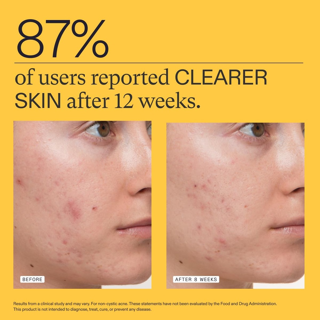 nutrafol-clear-skin-acne-supplement-for--4.jpg