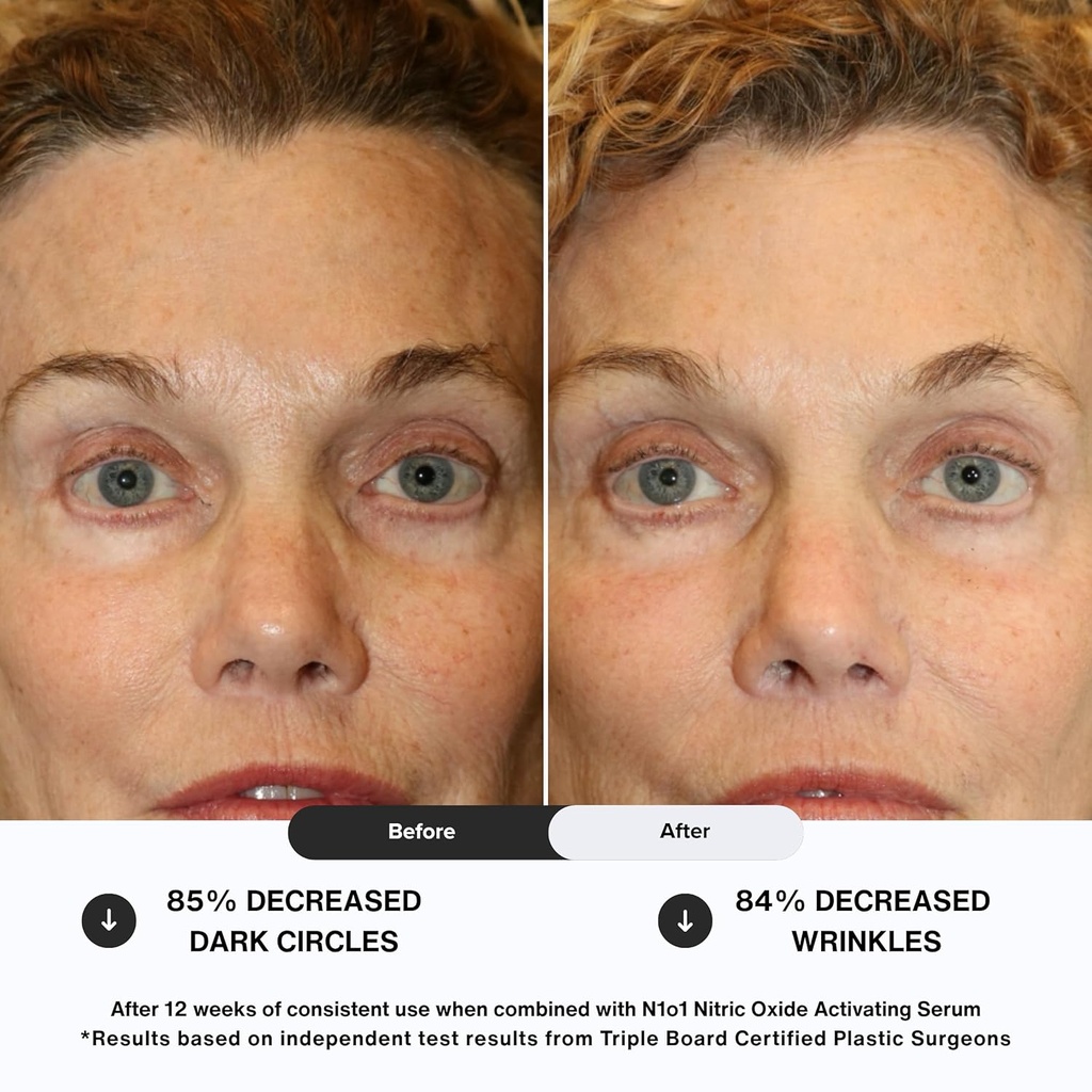 age-defiance-eye-cream---day-night-moist-6.jpg