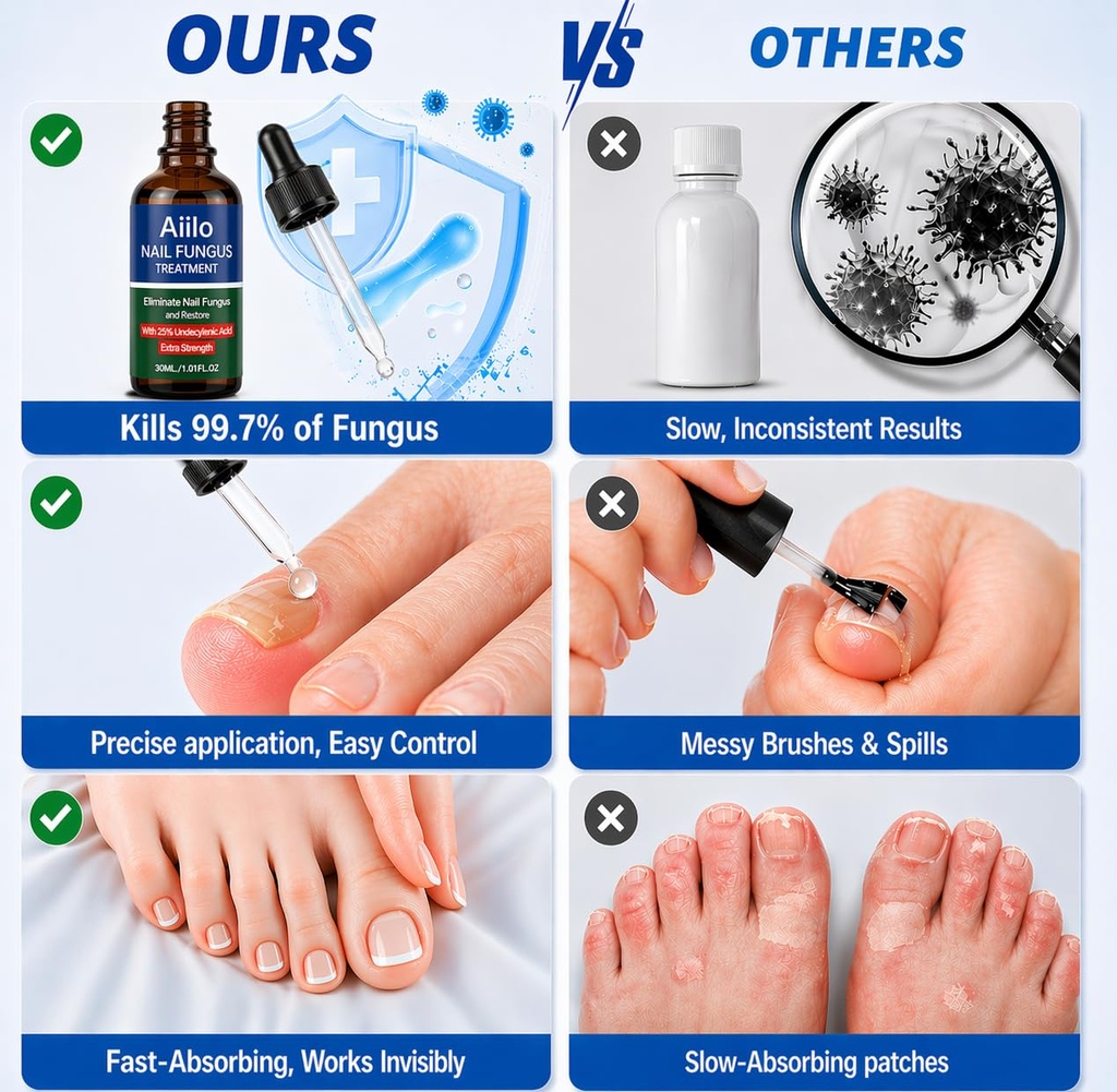 nail-fungus-treatment-25-undecylenic-aci-6.jpg