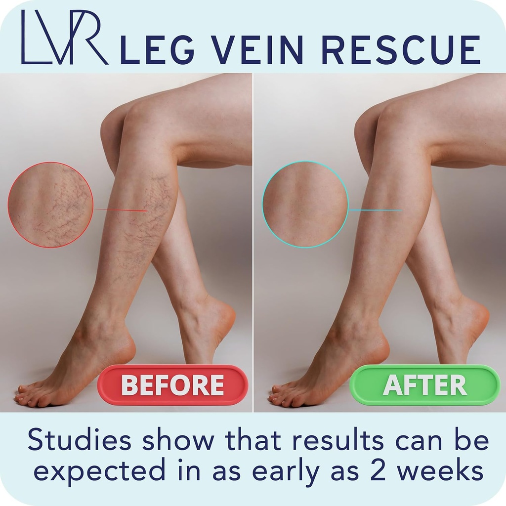 clinically-studied-diosmin-varicose-vein-6.jpg