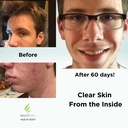 clear-skin-acne-vitamin-system-20-antiox-4.jpg