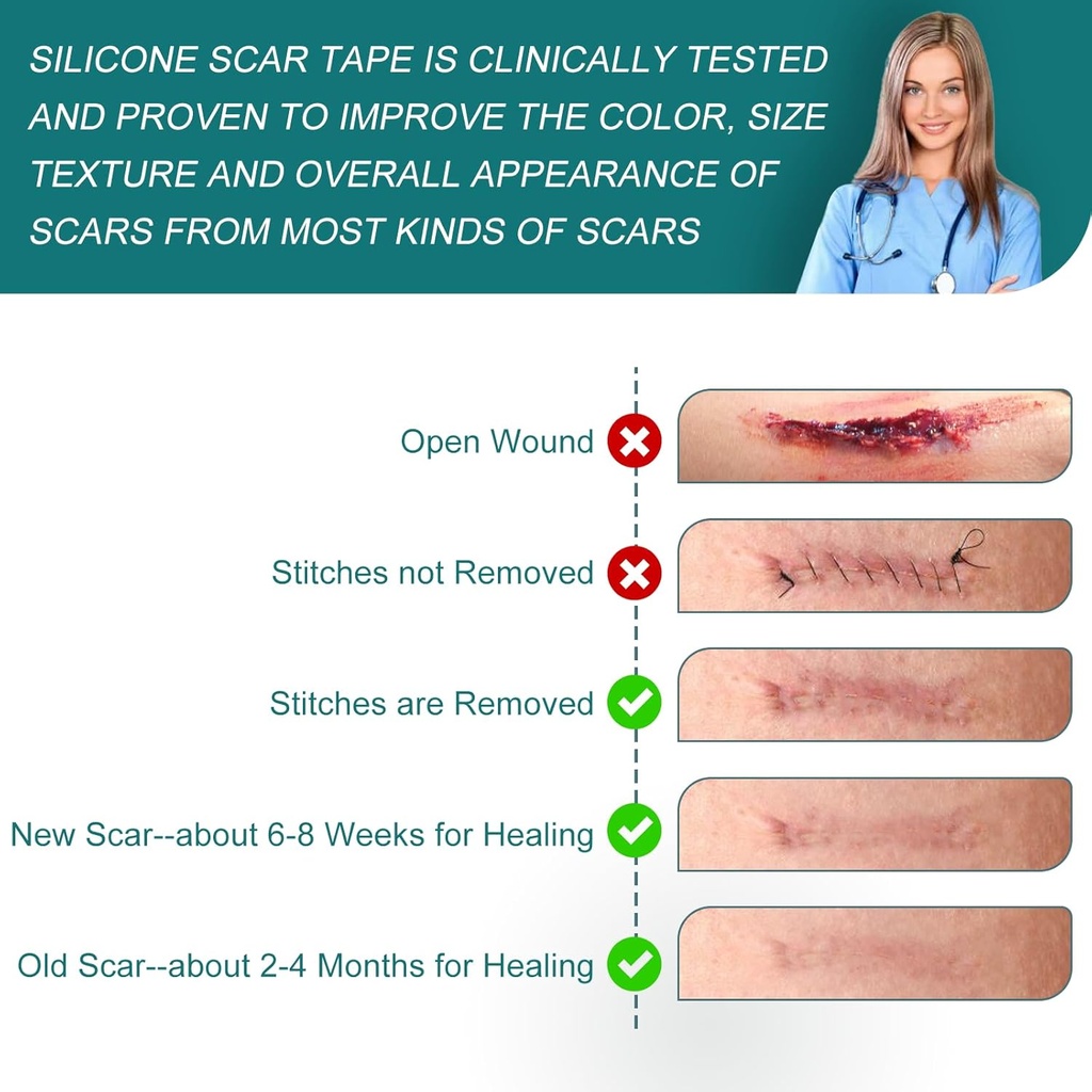 silicone-scar-sheets-16x-158-roll-4m-sil-6.jpg