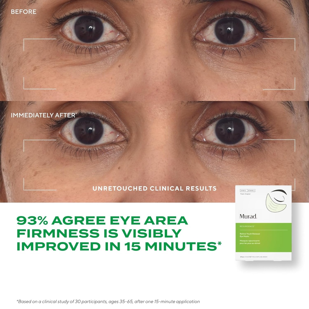 murad-dr-zion-retinol-youth-renewal-eye--4.jpg