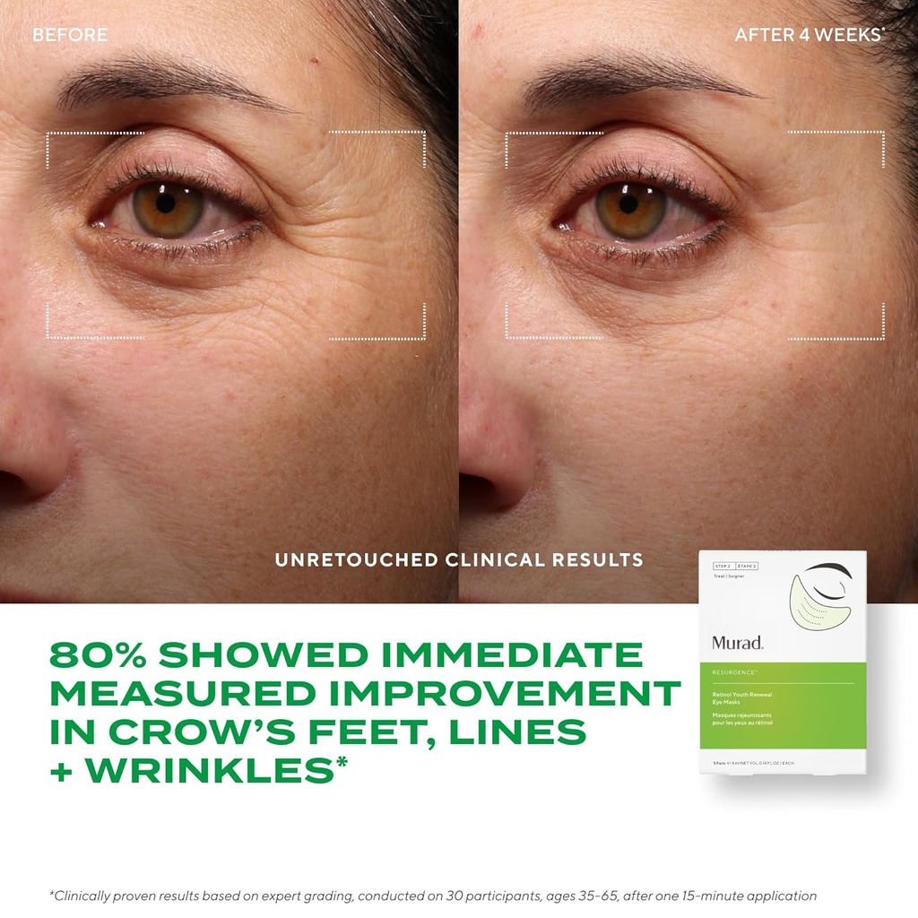 murad-dr-zion-retinol-youth-renewal-eye--5.jpg