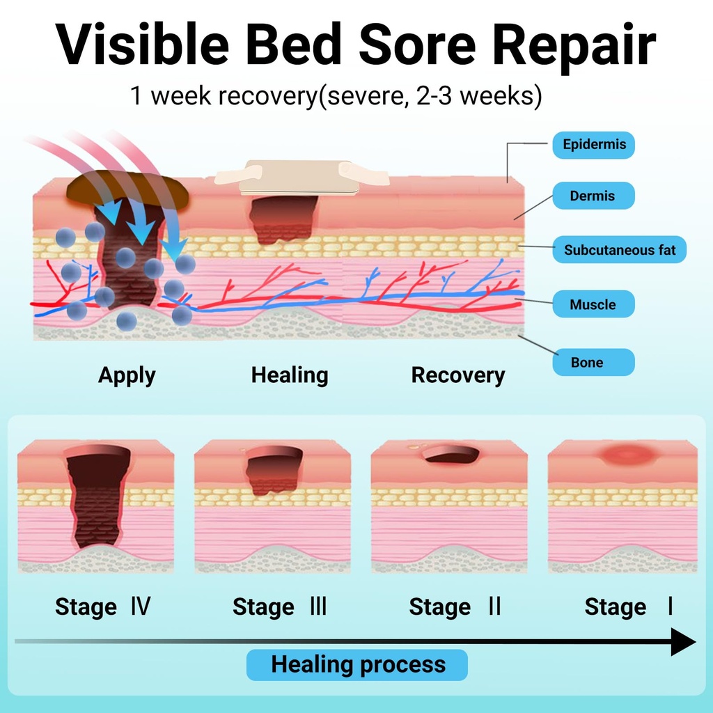 ishancare-bed-sore-cream-fast-safe-natur-6.jpg