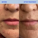 codex-labs-shaant-skin-de-stress-supplem-3.jpg