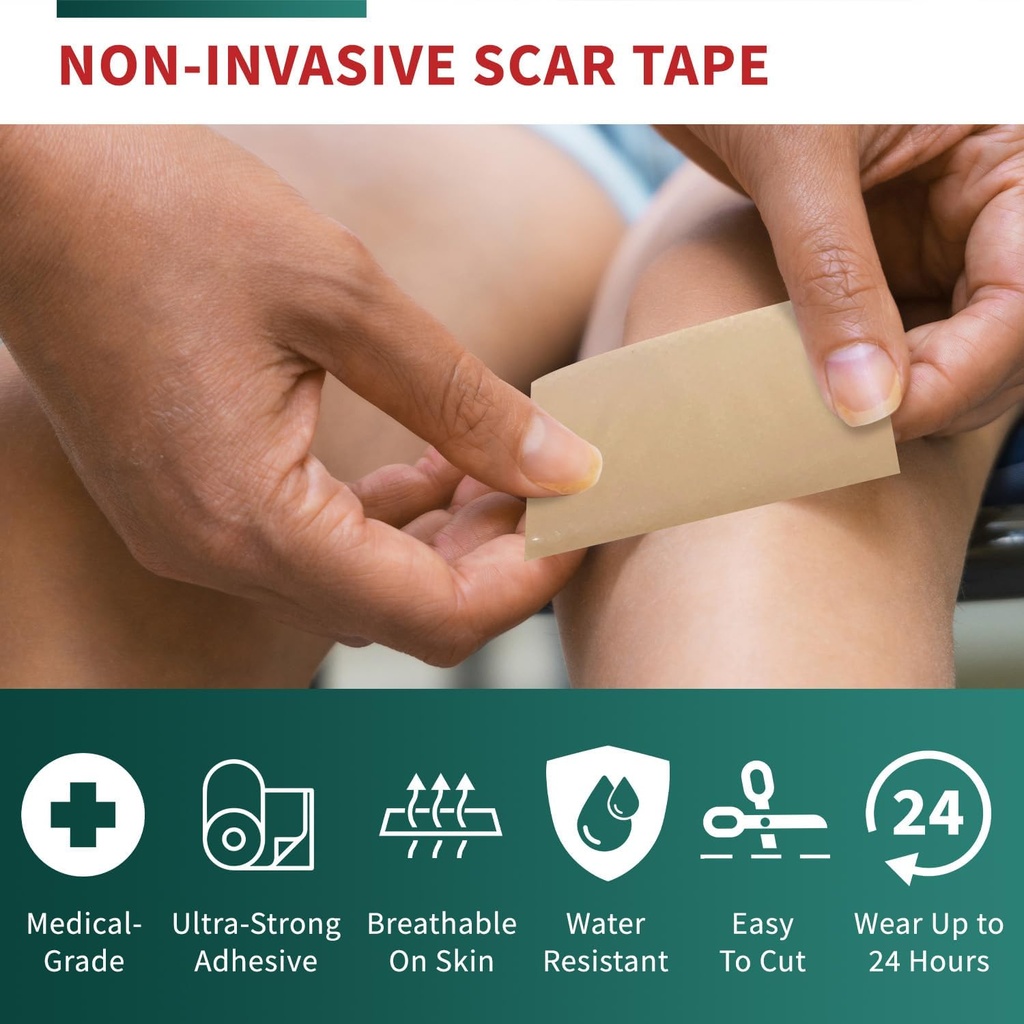 medical-grade-silicone-scar-tape-advance-4.jpg