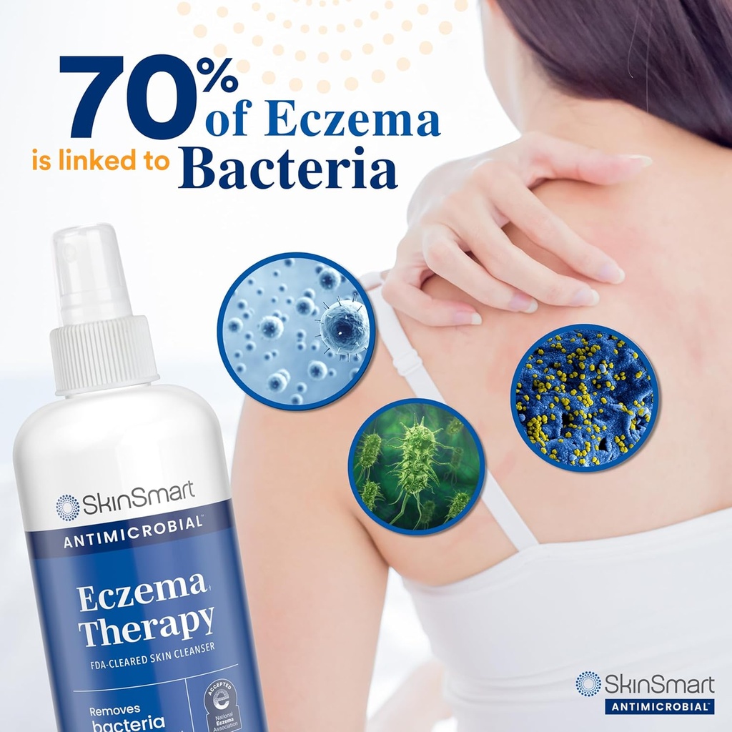 skinsmart-antimicrobial-eczema-therapy-w-2.jpg