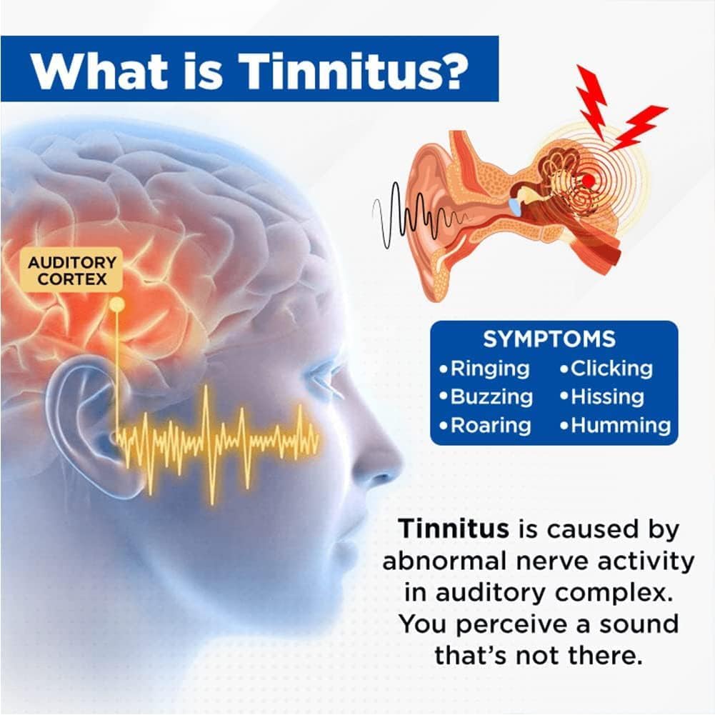 acupeace-tinnitus-relief-device-auricalm-5.jpg
