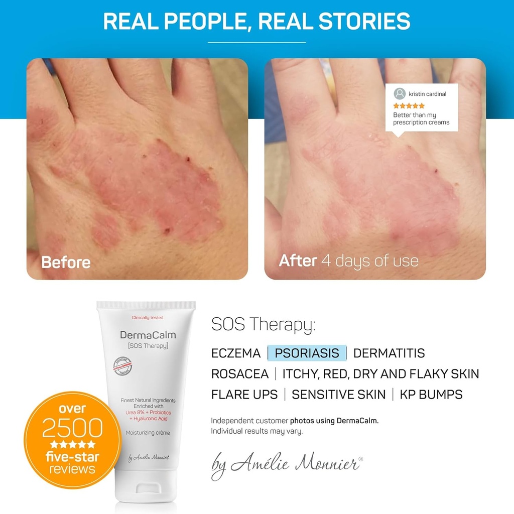 clinically-tested-dermacalm-sos-therapy--3.jpg
