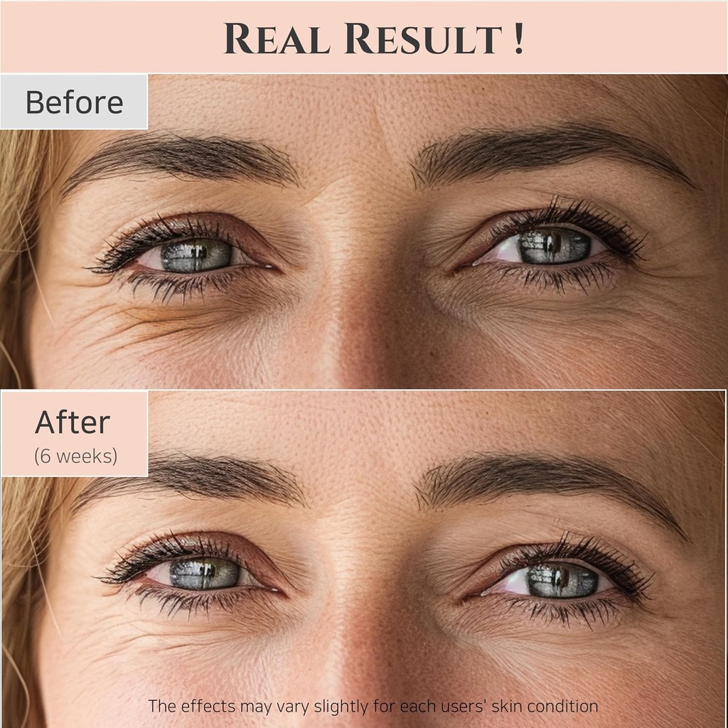 beauty-of-joseon-revive-eye-serum-with-r-4.jpg