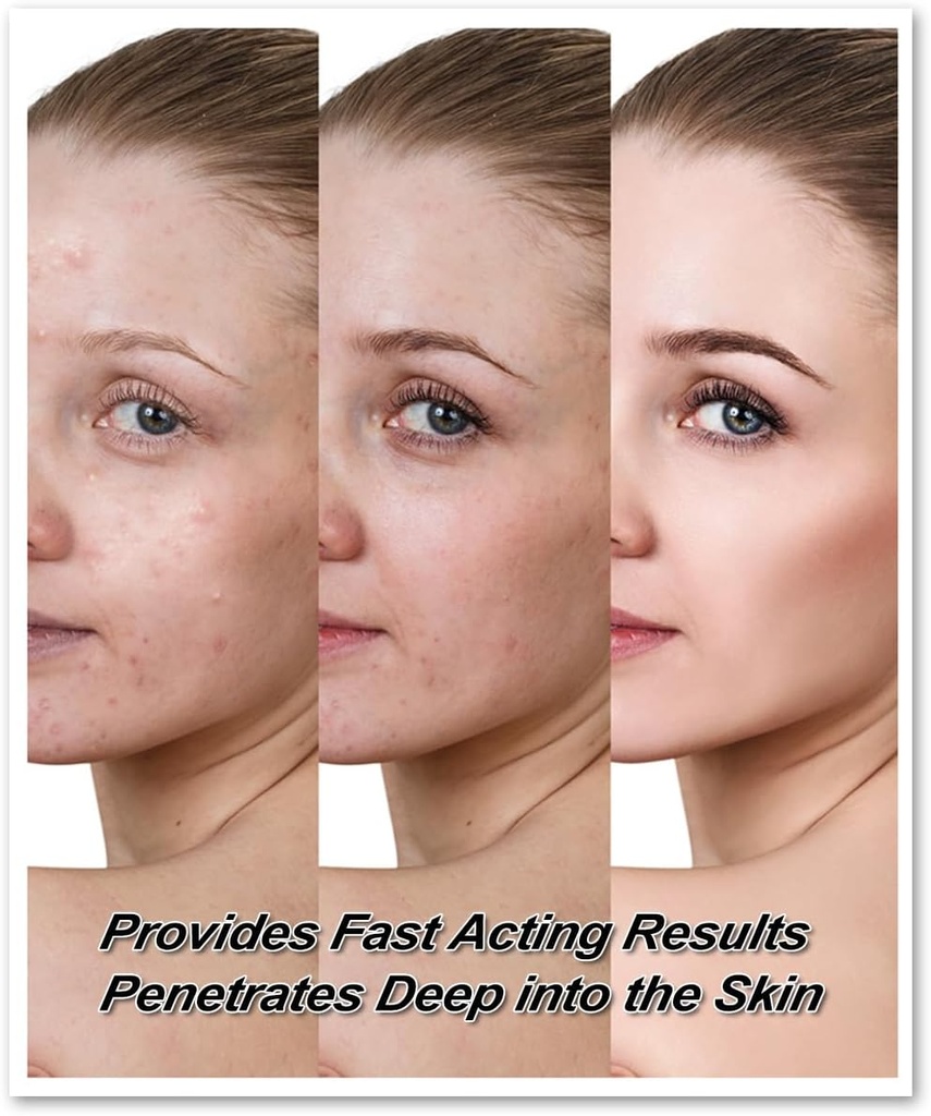 dermatitis-inflammation-and-rashes-body--4.jpg