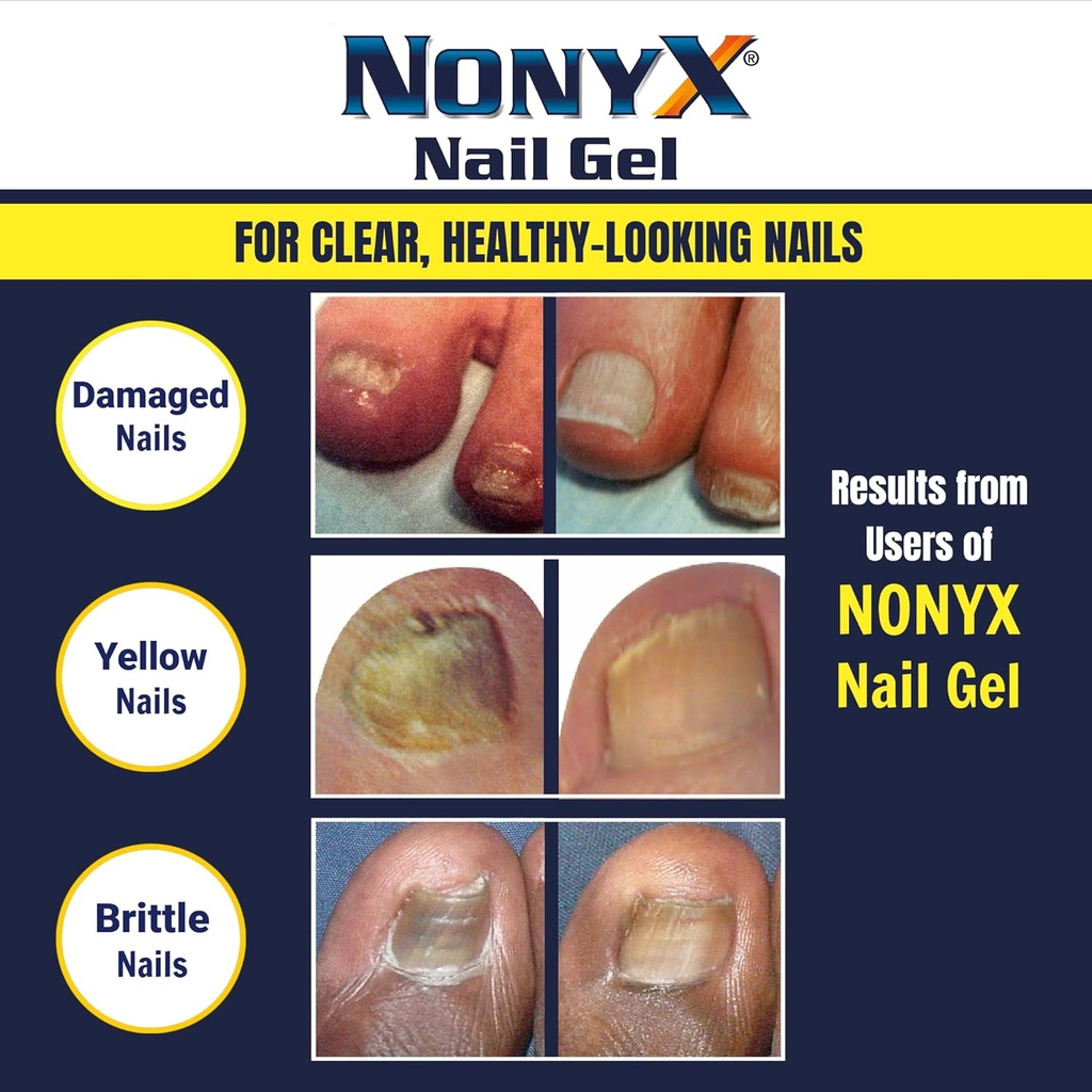 fungal-nail-clarifying-gel-clinically-pr-5.jpg