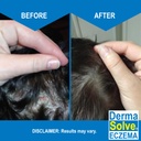 eczema-shampoo-conditioner-combo-pack----3.jpg