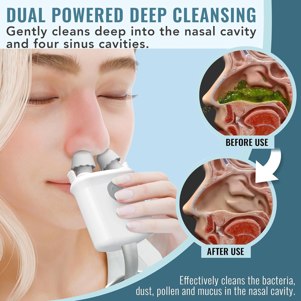 nasalfresh-md---dual-powered-nasal-irrig-5.jpg