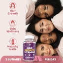 mommyz-love-postpartum-hair-loss-vitamin-6.jpg