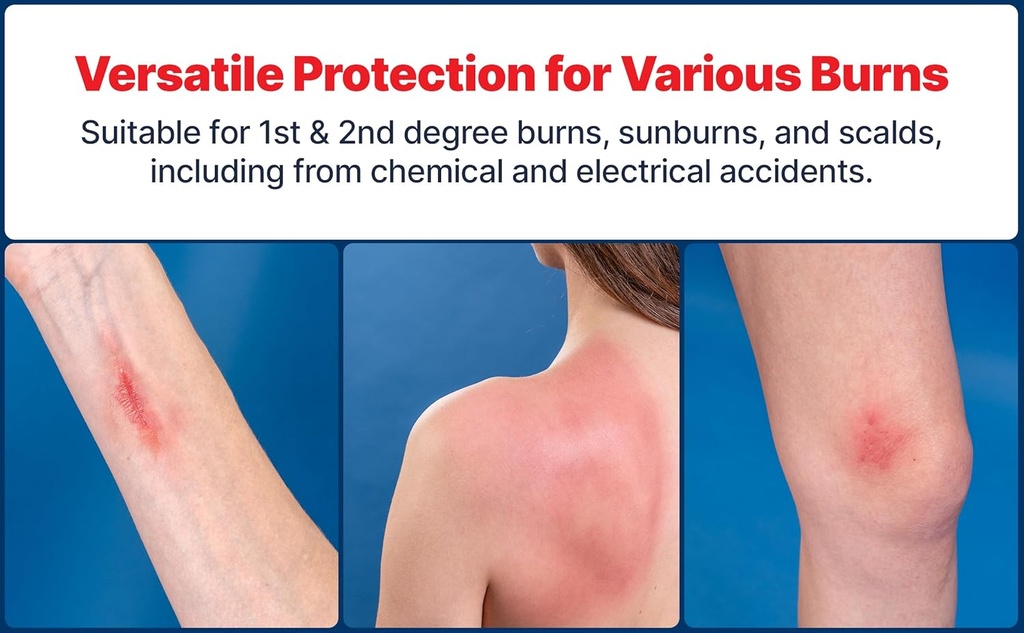 burnfix-hydrogel-burn-spray-120-ml-insta-4.jpg