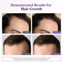 biotin-10-000mcg-hair-growth-support-for-6.jpg