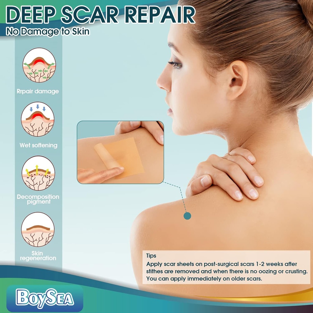professional-silicone-scar-sheets-16-x-1-4.jpg