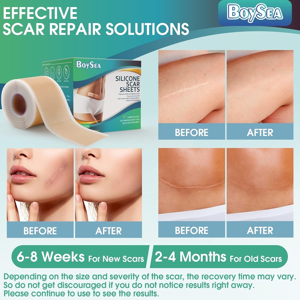 professional-silicone-scar-sheets-16-x-1-5.jpg