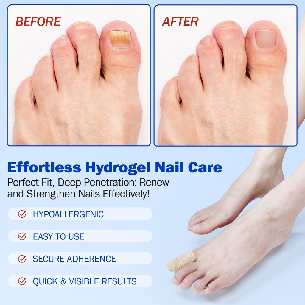 nail-patches-21pcs-toenail-treatment-ext-5.jpg