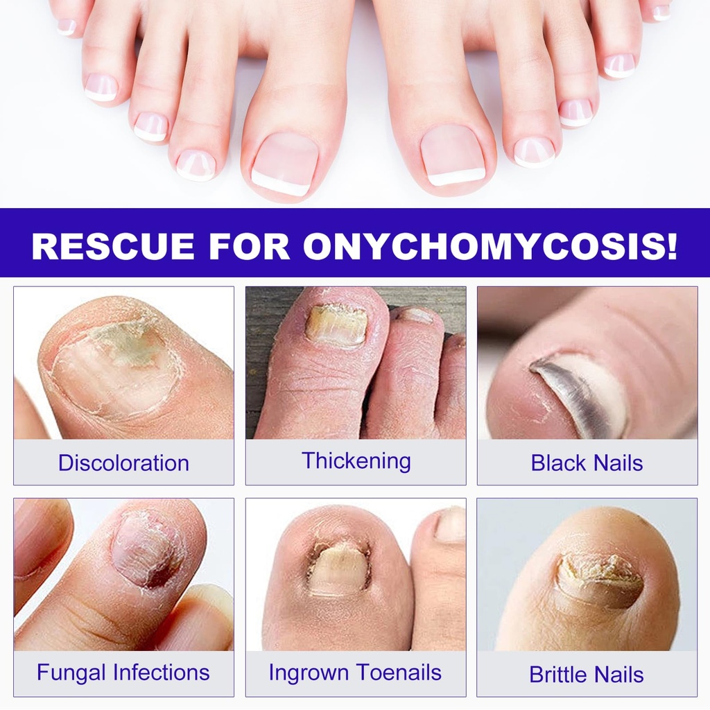 toenail-fungus-treatment-extra-strength--5.jpg
