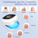 nail-fungus-laser-treatment-led-light-de-5.jpg