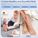 nail-fungus-laser-treatment-led-light-de-3.jpg