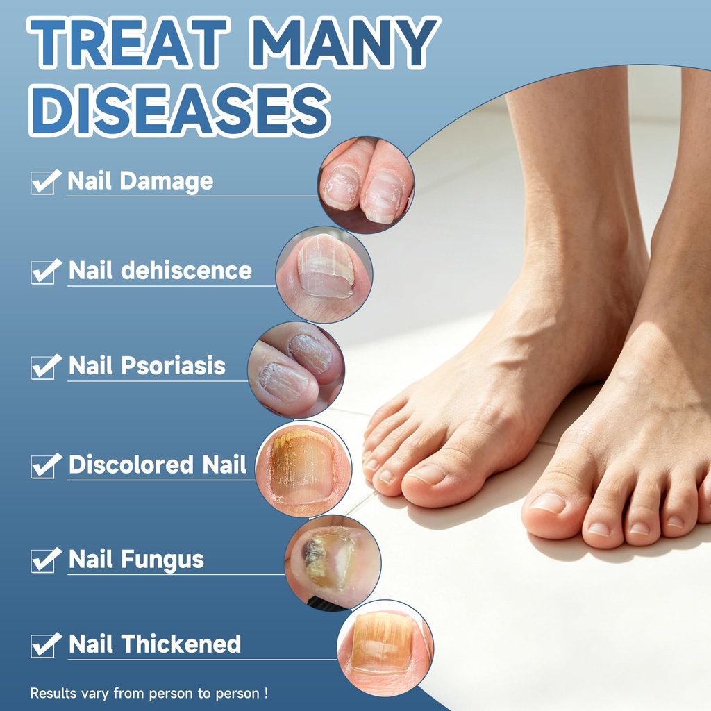 maximum-strength-nail-fungus-treatment-f-3.jpg