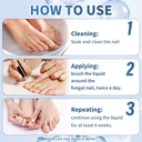 maximum-strength-nail-fungus-treatment-f-5.jpg