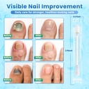 fungal-nail-treatment-swabs-100-ct-extra-3.jpg