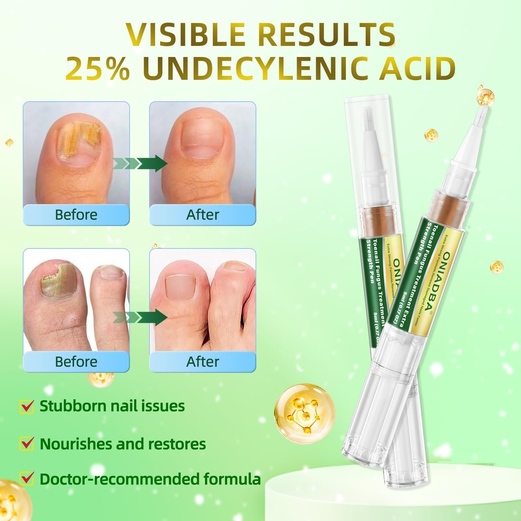 toenail-fungus-treatment-pen-extra-stren-2.jpg