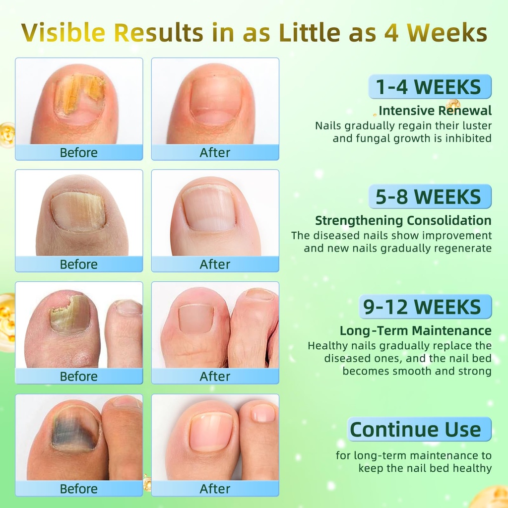 toenail-fungus-treatment-pen-extra-stren-3.jpg